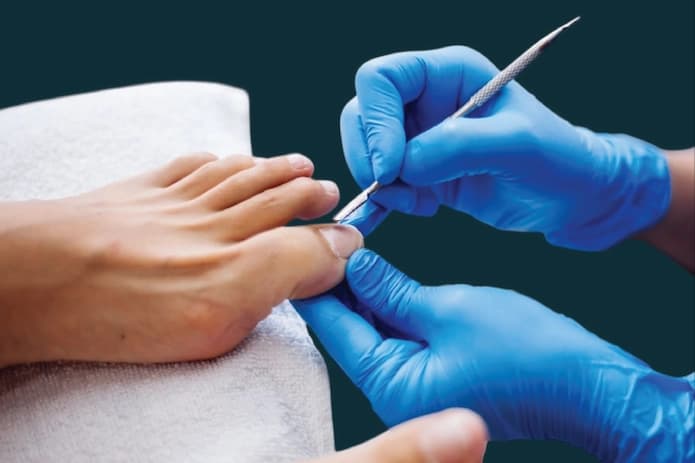 Estética de Pies